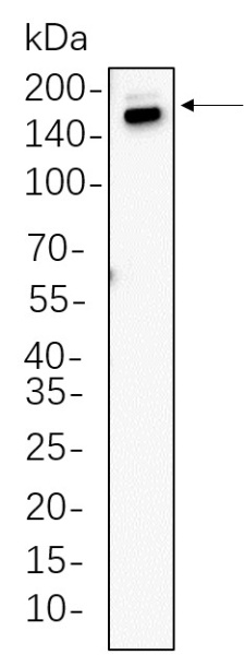 Recombinant Thrombospondin 1 Monoclonal Antibody (AN300679L)