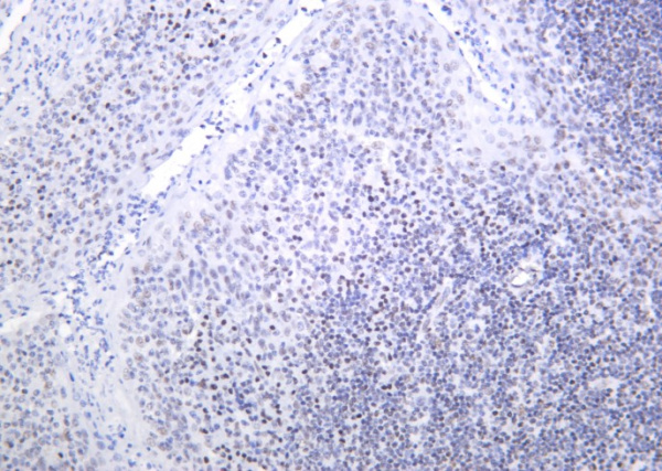 Recombinant Bmi-1 Monoclonal Antibody (AN301273L)