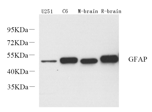 GFAP Polyclonal Antibody (E-AB-70040)