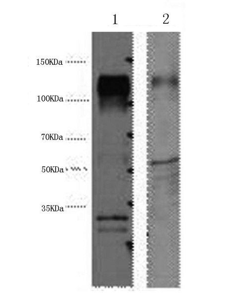ERBB2 Monoclonal Antibody (E-AB-22008)