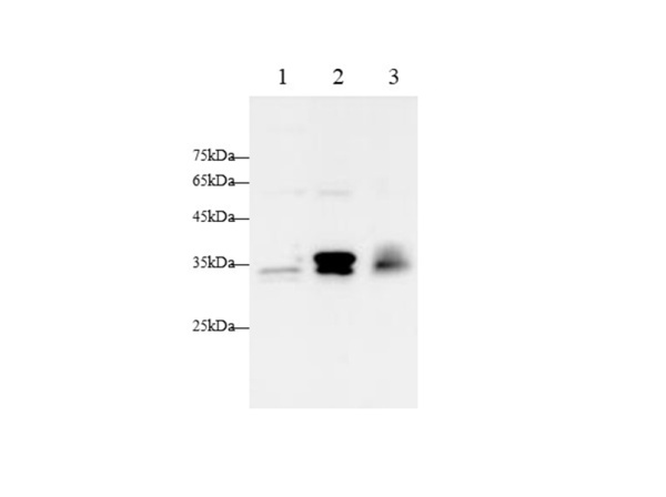 Pentraxin 3/TSG-14 Polyclonal Antibody (AN006880L)