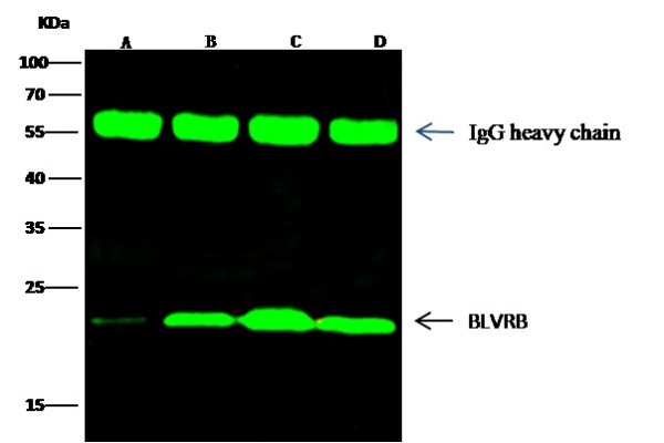 Recombinant BLVRB/biliverdin reductase B Monoclonal Antibody (AN300265P)
