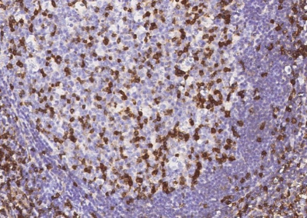 Recombinant IFITM1 Monoclonal Antibody (AN300169P)