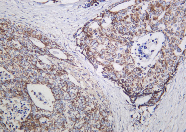 Recombinant NDUFS1 Monoclonal Antibody (AN301165L)