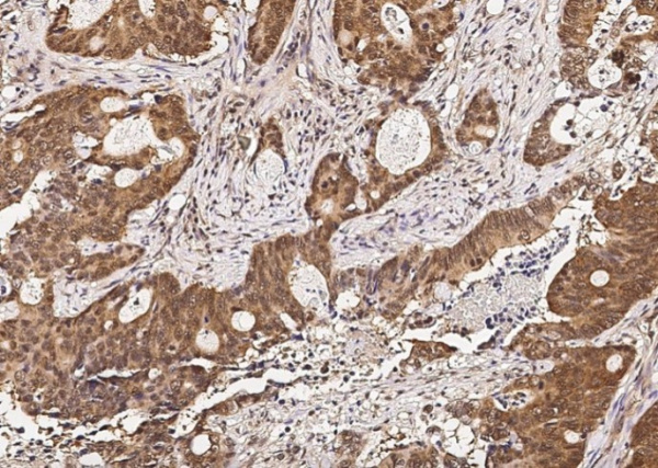 RUVBL1/RVB1 Monoclonal Antibody (AN200082P)