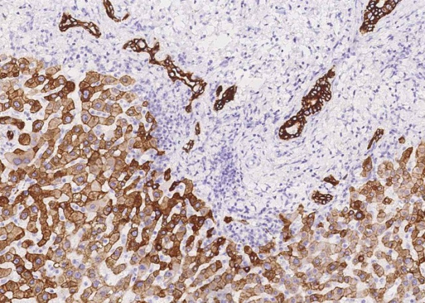 Cytokeratin 8 Monoclonal Antibody (AN200190P)