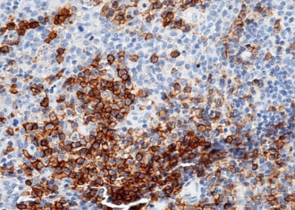 Recombinant CD38 Monoclonal Antibody (AN300015P)