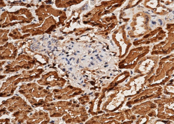 Recombinant ACY1/Aminoacylase-1 Monoclonal Antibody (AN300343P)