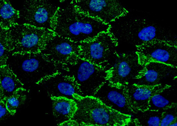 Recombinant beta-Catenin/CTNNB1 Monoclonal Antibody (AN300396P)
