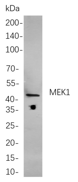 Recombinant MEK1 Monoclonal Antibody (AN300935L)