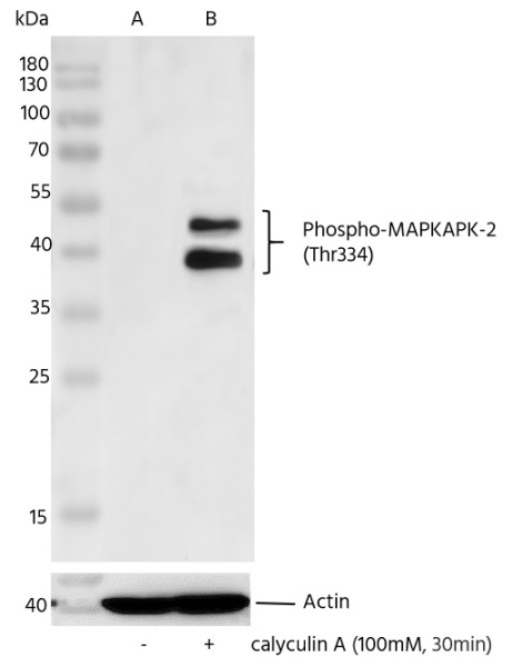 Recombinant Phospho-MAPKAPK-2 (Thr334) Monoclonal Antibody (AN300153L)