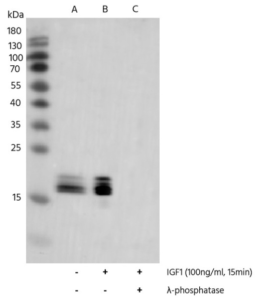 Recombinant Phospho-4E-BP1 (Thr37, 46) Monoclonal Antibody (AN300049L)