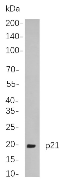 Recombinant p21 Monoclonal Antibody (AN301027L)