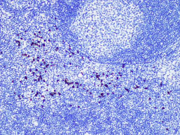 Granzyme B Monoclonal Antibody (ELAB5024-R)
