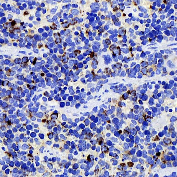 CD284 Monoclonal Antibody (E-AB-70229)