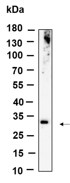 Recombinant ZNF364 Monoclonal Antibody (AN301197L)