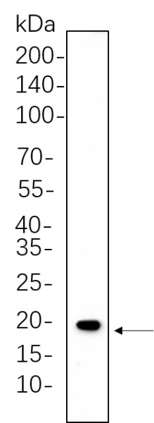 Recombinant Caveolin-1 Monoclonal Antibody (AN300820L)
