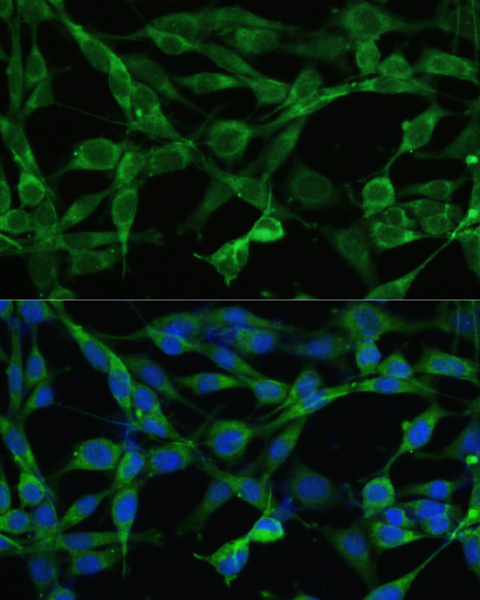 SMAD3 Polyclonal Antibody (E-AB-66984)
