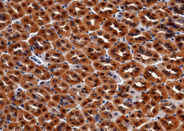 Recombinant Carbonic Anhydrase II/Car2 Monoclonal Antibody (AN300544P)
