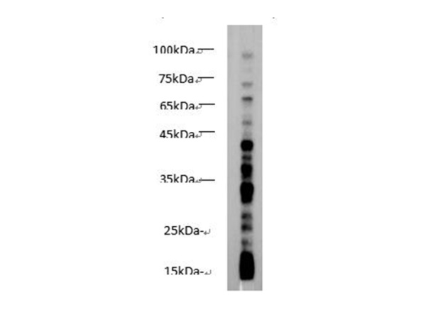 Butyryl Lysine Polyclonal Antibody (E-AB-40547)