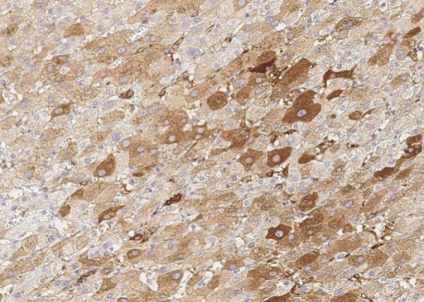 Recombinant CSEN/calsenilin/KCNIP3 Monoclonal Antibody (AN300283P)