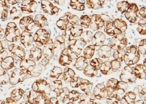 Recombinant Carbonic Anhydrase IX/CA9 Monoclonal Antibody (AN300177P)