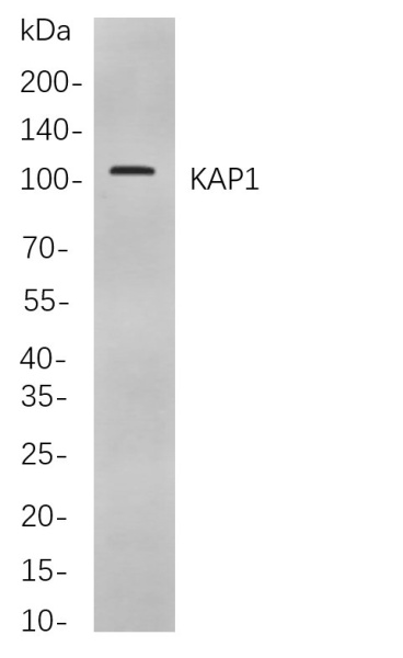 Recombinant KAP1 Monoclonal Antibody (AN300993L)