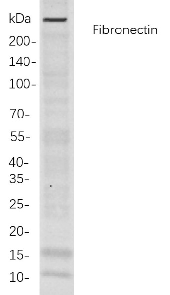Recombinant Fibronectin Monoclonal Antibody (AN300879L)