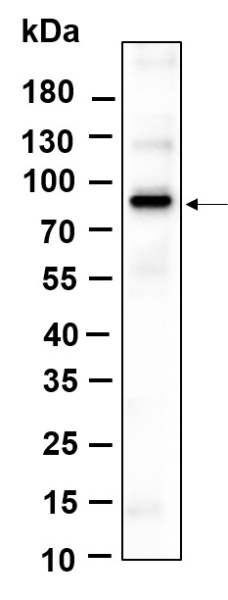 Recombinant Phospho-β Catenin (Ser37) Monoclonal Antibody (AN301131L)
