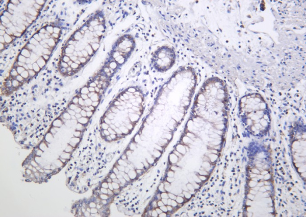 Recombinant AMPKβ1 Monoclonal Antibody (AN301259L)
