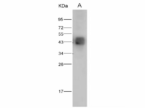 Anti-Dengue virus DENV-2(Strain New Guinea C/PUO-218 hybrid) E/Envelope Protein Antibody Polyclonal Antibody (E-AB-V1070)