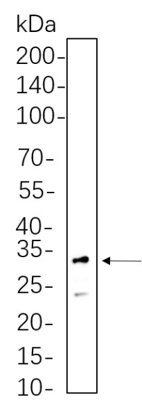 Recombinant RPS6 Monoclonal Antibody (AN300704L)