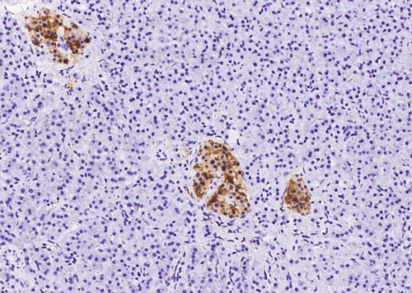 Recombinant Synaptophysin/SYP Monoclonal Antibody (AN300291P)