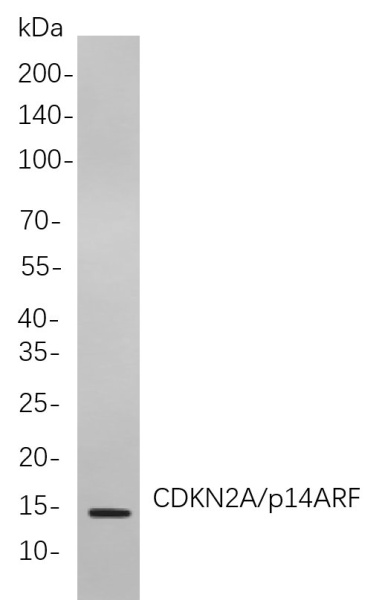 Recombinant CDKN2A/p14ARF Monoclonal Antibody (AN301075L)