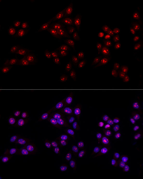 Ki67 Polyclonal Antibody (E-AB-68276)