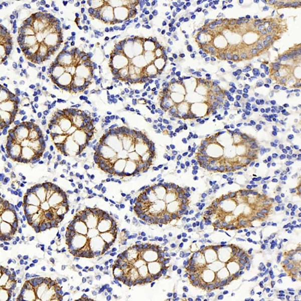Claudin 5 Polyclonal Antibody (E-AB-70148)