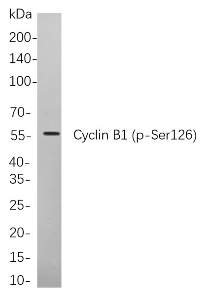 Recombinant Phospho-Cyclin B1 (Ser126) Monoclonal Antibody (AN300987L)