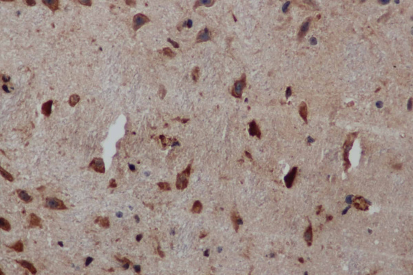 PIK3CB Polyclonal Antibody (E-AB-16714)