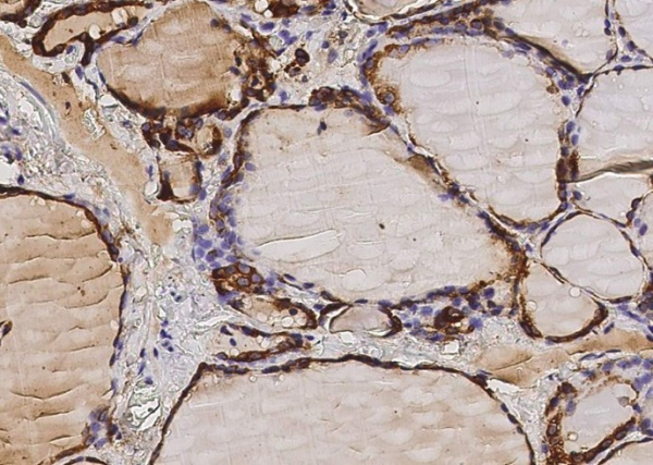 Thyroid peroxidase/TPO Monoclonal Antibody (AN200225P)