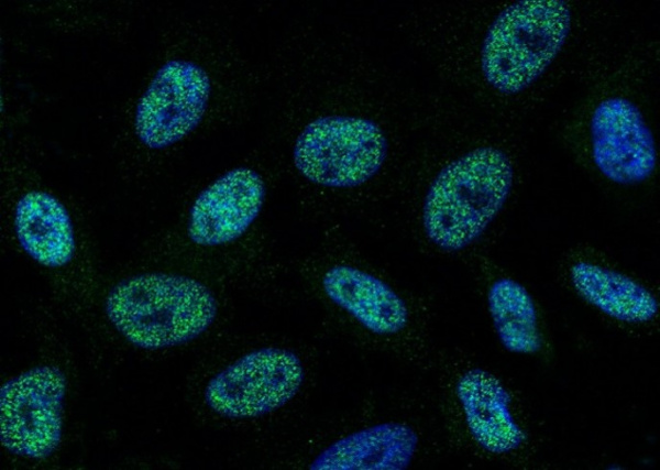 SAE1 Monoclonal Antibody (AN200081P)