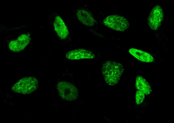 Histone H3 Monoclonal Antibody (AN200151P)