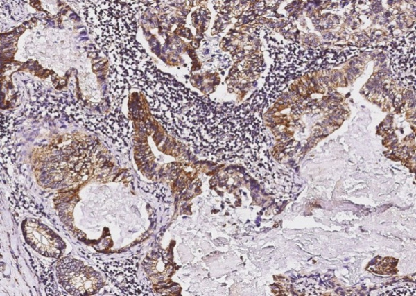 Tie1 Monoclonal Antibody (AN200055P)