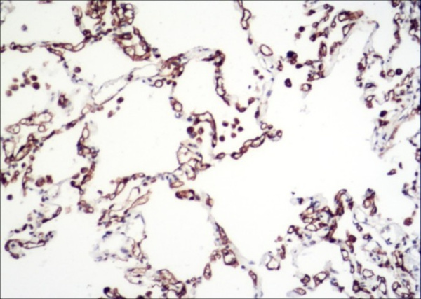 Recombinant Carbonic Anhydrase IV/CA4 Monoclonal Antibody (AN300189P)