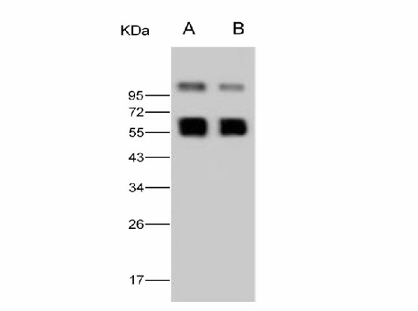 Anti-West Nile Virus(WNV)(lineage 1, strain NY99) NS1 Polyclonal Antibody (E-AB-V1326)