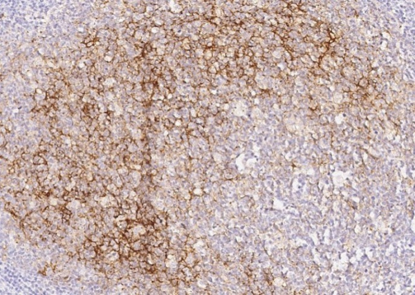 CD14 Monoclonal Antibody (AN200093P)