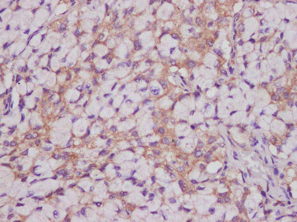 CEACAM-1/CD66a Polyclonal Antibody (AN005960L)