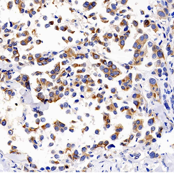 BSG Polyclonal Antibody (E-AB-70271)