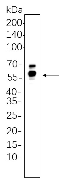 Recombinant GPER1 Monoclonal Antibody (AN300685L)