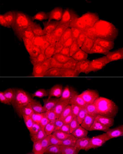 POU4F1 Polyclonal Antibody (E-AB-92459)
