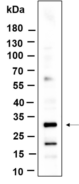 Recombinant KCTD21 Monoclonal Antibody (AN301201L)